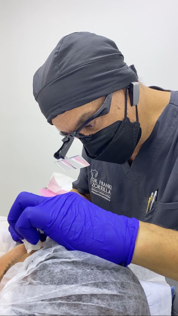 Tratamientos Estéticos armonizacion facial 01