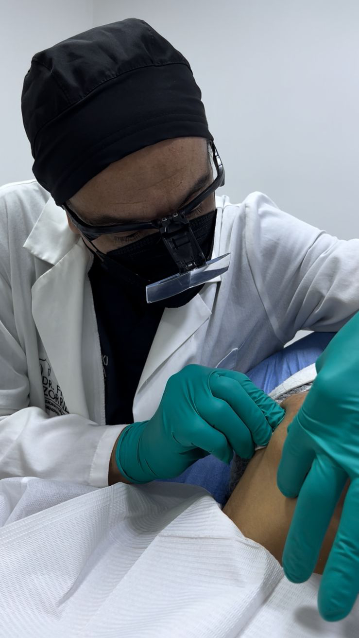 Tratamientos Estéticos armonizacion facial 02