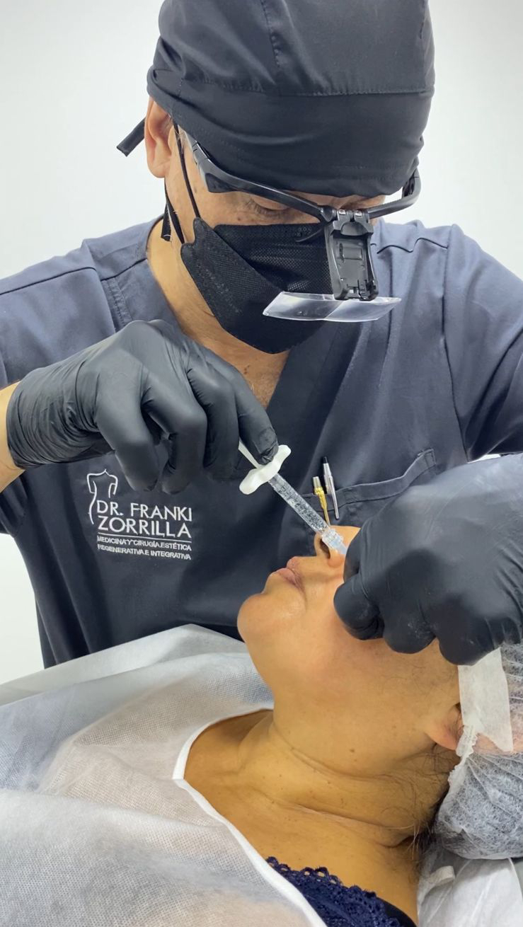 Tratamientos Estéticos armonizacion facial 03