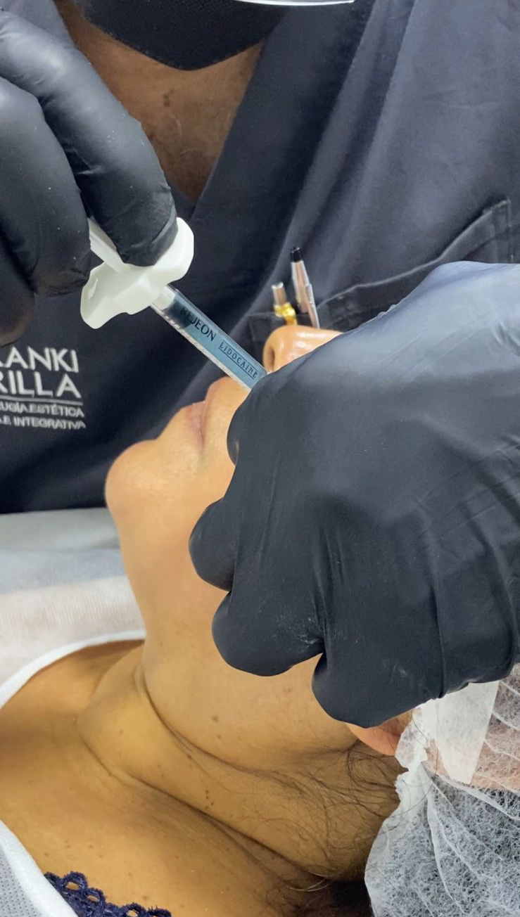 Tratamientos Estéticos armonizacion facial 04