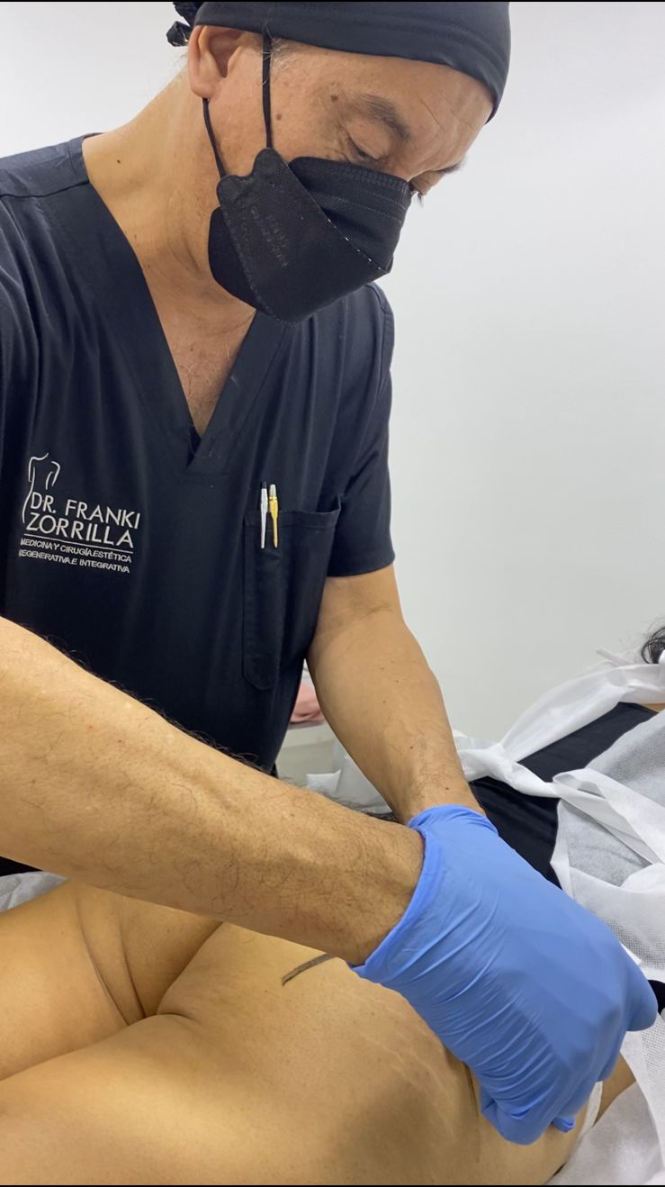 Tratamientos Estéticos aumento de gluteos 01