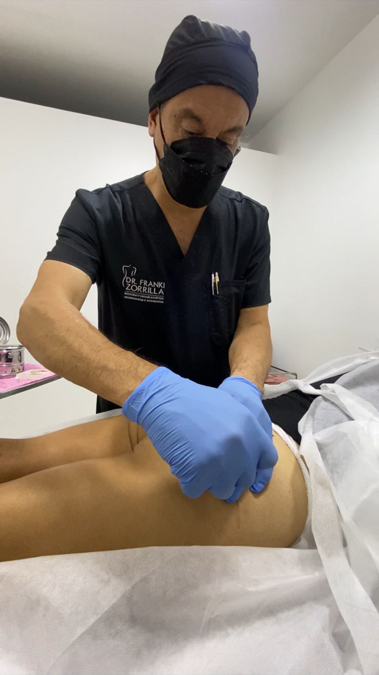 Tratamientos Estéticos aumento de gluteos 02