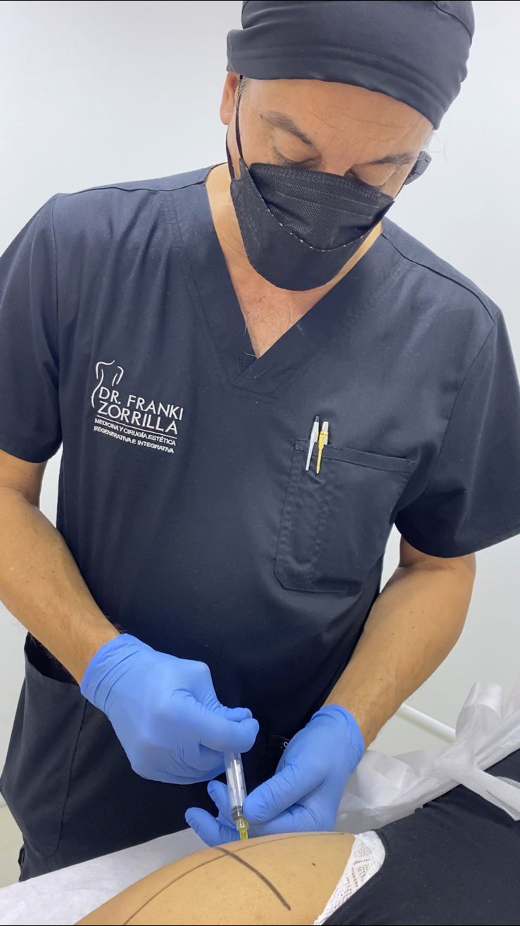 Tratamientos Estéticos aumento de gluteos 04