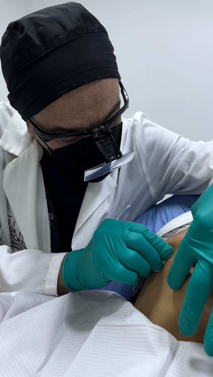 Tratamientos Estéticos bioestimuladores de colageno 02