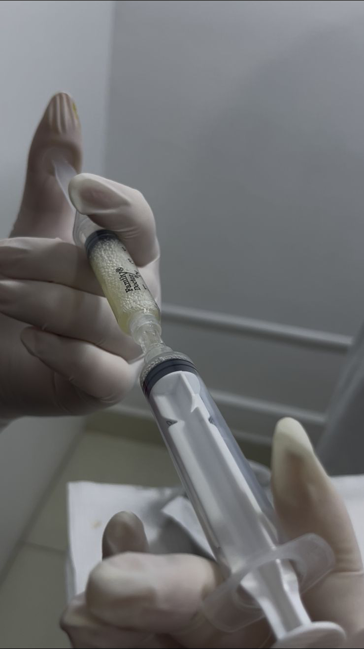 Tratamientos Estéticos bioestimuladores de colageno 03