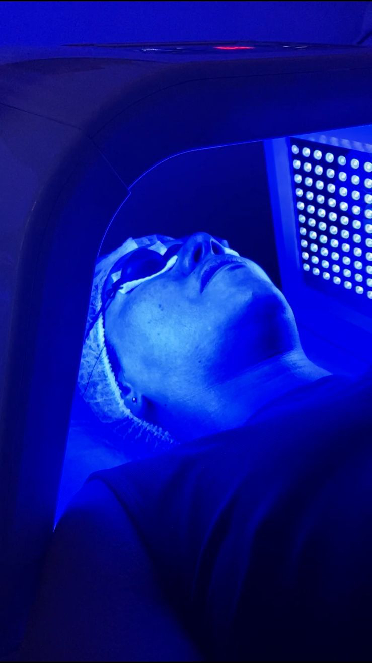 Tratamientos Estéticos limpieza facial 01