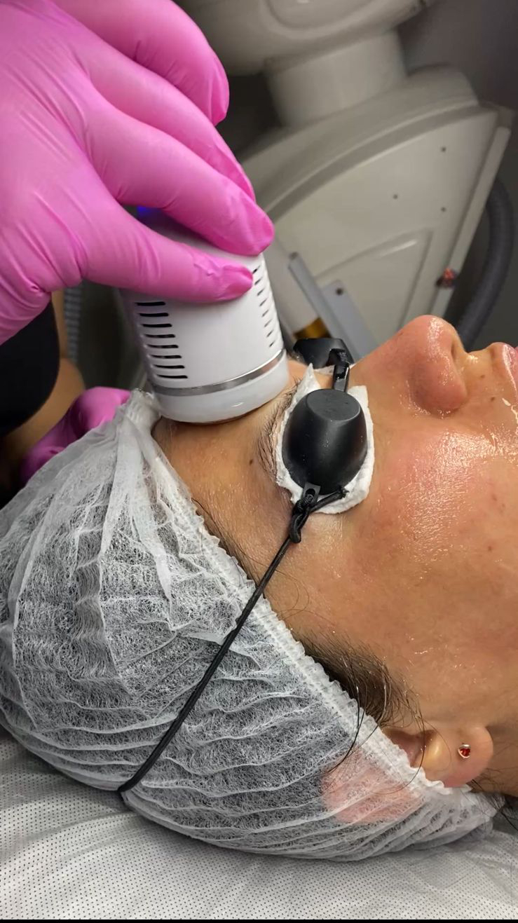Tratamientos Estéticos limpieza facial 02