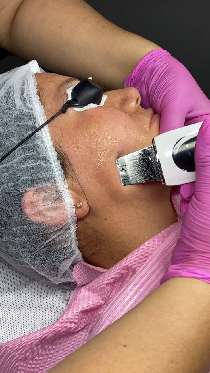 Tratamientos Estéticos limpieza facial 03
