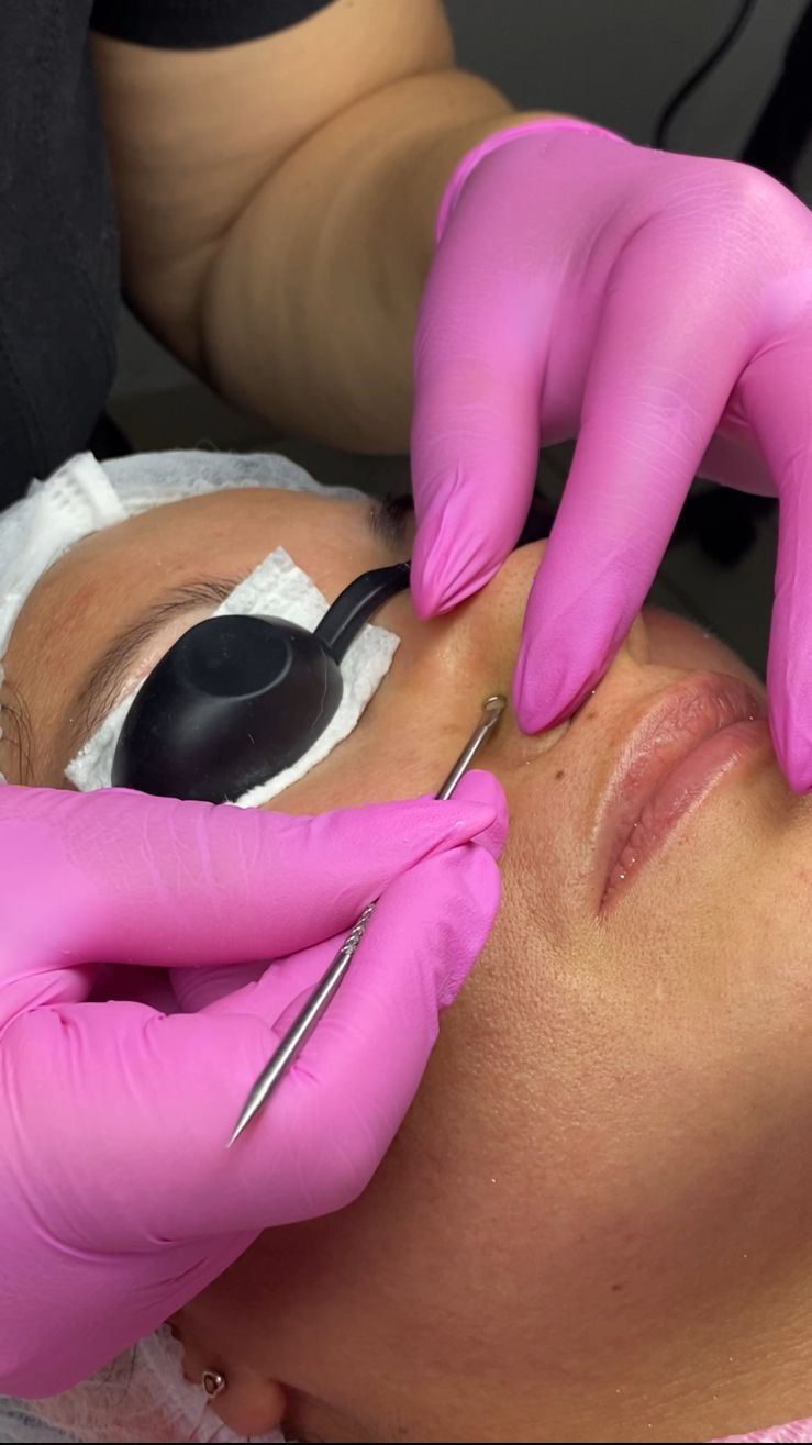 Tratamientos Estéticos limpieza facial 04